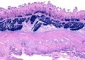 Duodenum, Human, PBA/Kernechtrot, 40x - Hsitological Artificial inteligence