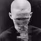 Apotosis