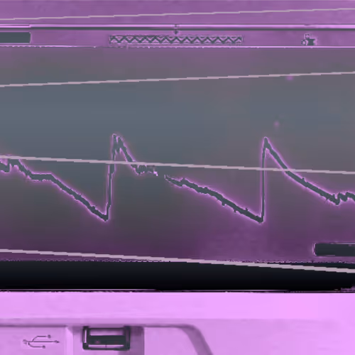 WorsenAll - Scope Sessions - Cryptoph