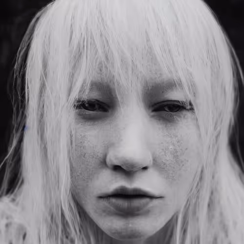 Albino Women AI