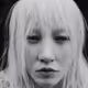 Albino Women AI