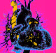CT reconstruction