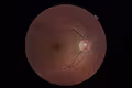 The Optic Nerve Collection - old