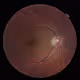 The Optic Nerve Collection - old