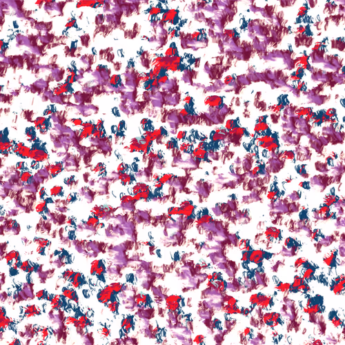 Memory Loss by Andrew Mitchell