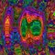 161