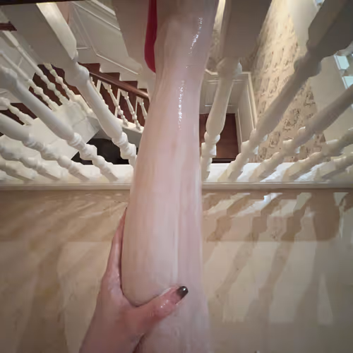 09874.lens-Collect-154