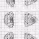 Stellarator division