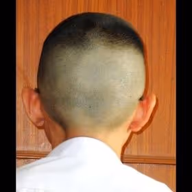 Hot head