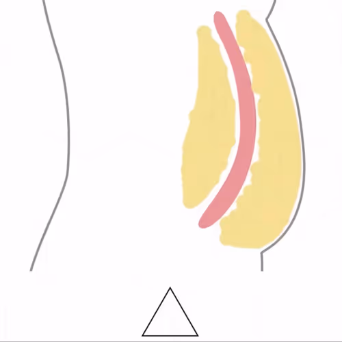 bb520.lens-Collect-350