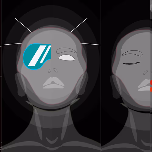 neon lost heads