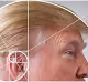 trumponacci