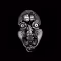 Mri Morfondier