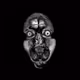Mri Morfondier