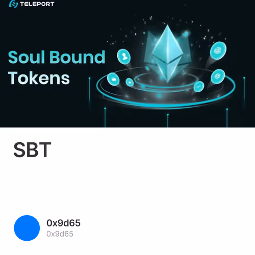 SBT