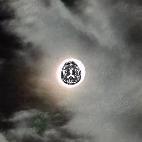 MyBrain in the Moon