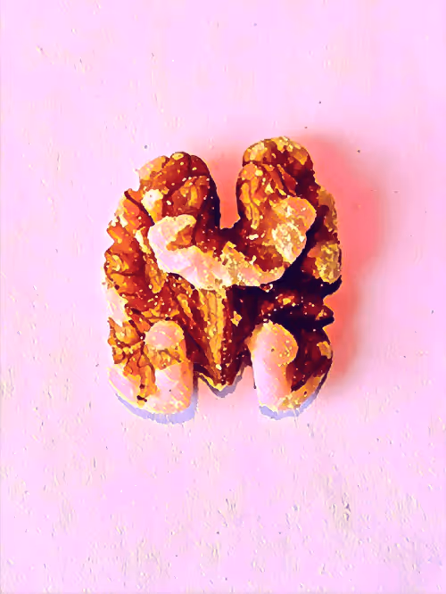 Item #23101555341256944767947780439913944949162078650248345617575226588336540876801 Media