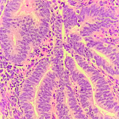 Item #69482328620963259394518629310031225359997111203048028238990119568564520222721 Media