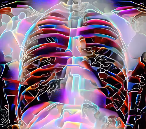XR Chest Limited Study #5