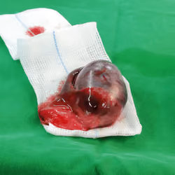 Testis