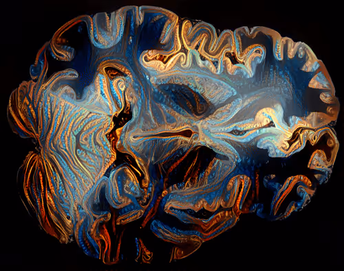 Item #29877578668728852178902598419785793077778618348046200683544678266771037224961 Media