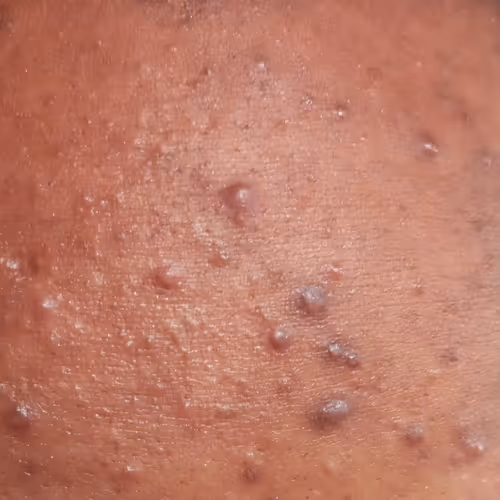 Untitled Collection #3828826604