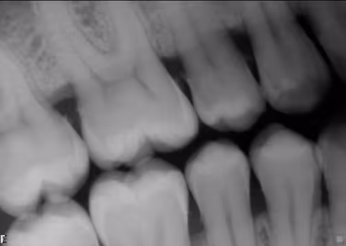 Item #93376678190954678858839947878343750687412347146075533458797855277869678198794 Media