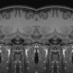 Reflection of a bridge to virtenity #1
