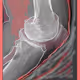 Knee X-ray update