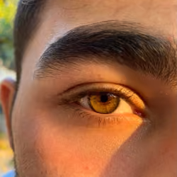 Honey Eye