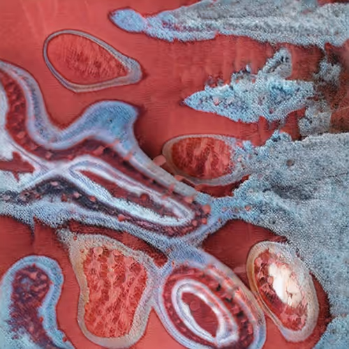 Item #58241160855422744817468407088196322100109565521561100950236906496965692358657 Media