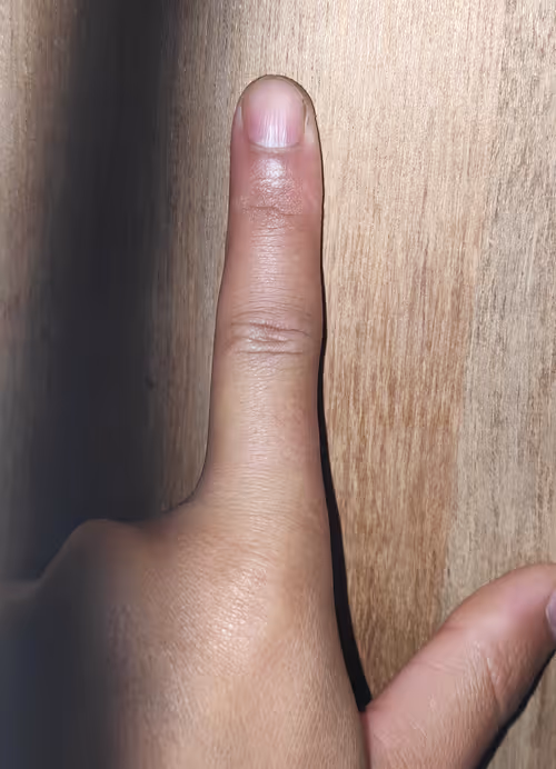 Item #87101312680793949185913621033399323976812514449934998567589402393911664574465 Media