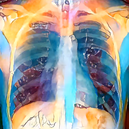 XR Chest Private Study #321