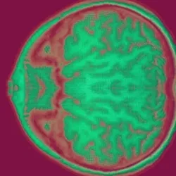 Meta cell colorization #2