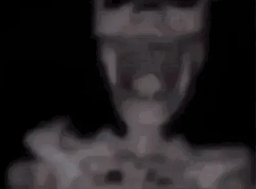 SKELETON