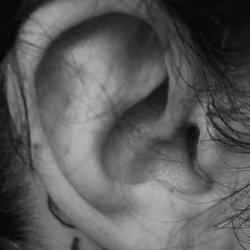 Right Ear