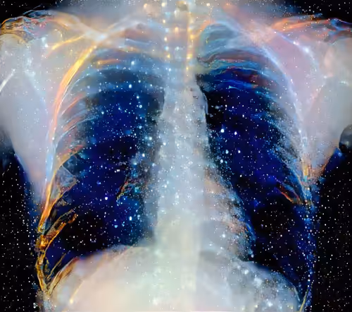 XR Chest Private Study #160