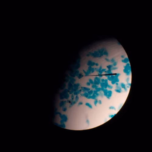 Microbiology #3 blue crescent