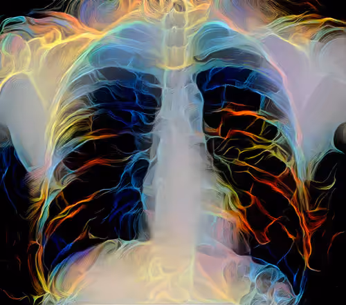 XR Chest Limited Study #12
