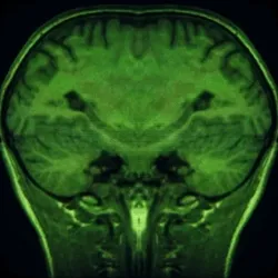 Pseudo-mechanical axon terminal #1