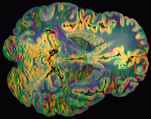 Item #29877578668728852178902598419785793077778618348046200683544678348134897680394 Media