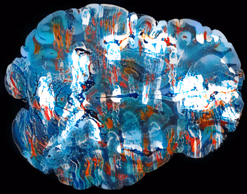 Item #29877578668728852178902598419785793077778618348046200683544678312950525591562 Media