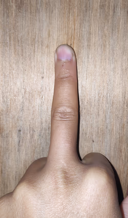 Item #87101312680793949185913621033399323976812514449934998567589402395011176202241 Media