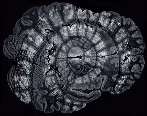 Item #29877578668728852178902598419785793077778618348046200683544678237084223275009 Media