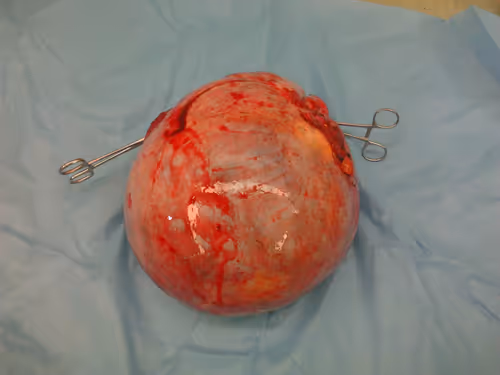 Item #3497995922478104050891848764723464450604765278000029707917531873446262210561 Media