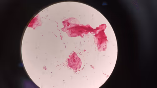 Item #54745154985906596137061195666257221774112717625342458029327300515987246284801 Media