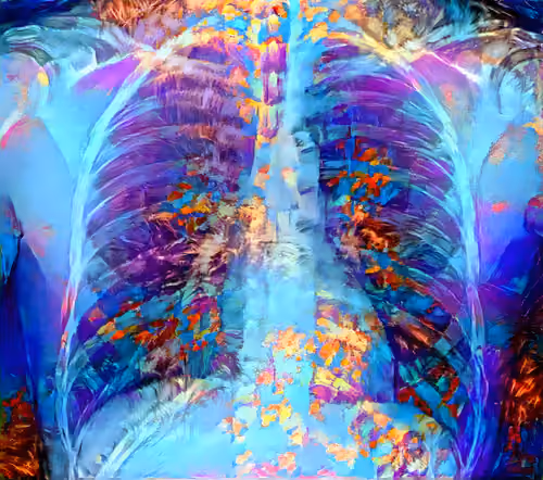 XR Chest Private Study #125