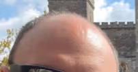 Nick's head