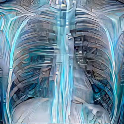XR Chest Private Study #106