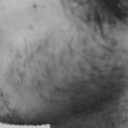 Left Cheek